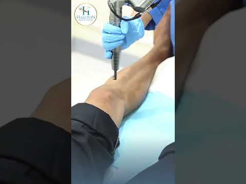 Carbon Spectra at Halcyon Medical Centre