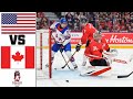 USA VS CANADA HIGHLIGHTS 2025 IIHF WORLD JUNIOR CHAMPIONSHIP USA VS CANADA HIGHLIGHTS 2025 IIHF WORLD JUNIOR CHAMPIONSHIP