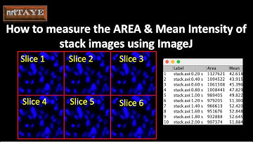 How to measure the AREA and Mean Intensity of Stack Images using ImageJ