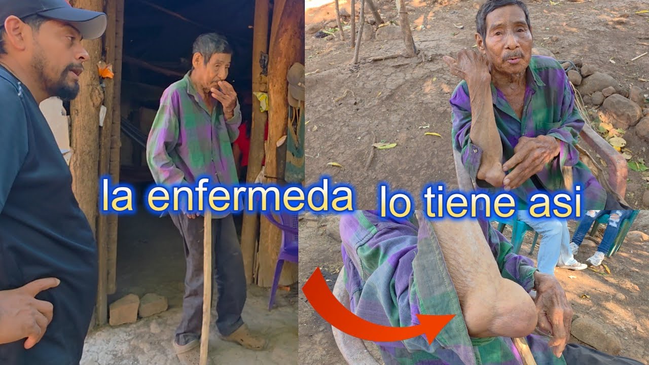 LE DIJO EL DOCTOR QUE LE QUEDA MENOS DEL AÑO DE VIDA