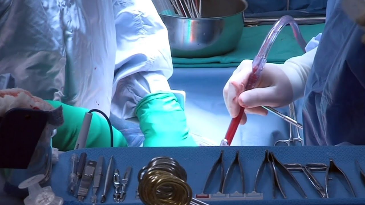 What everyone should know about non-surgical treatment for colorectal cancer