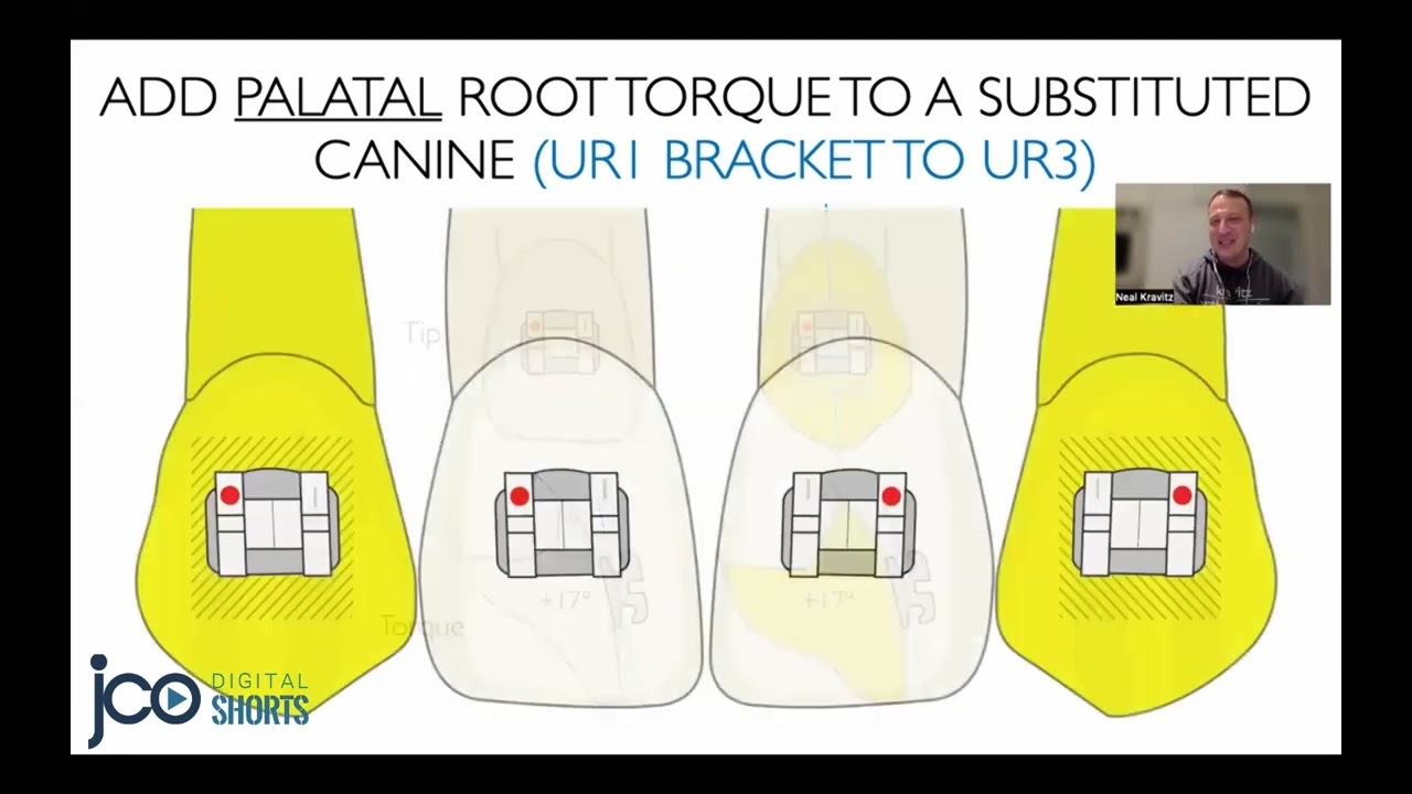 Замена скобок JCO Digital Short