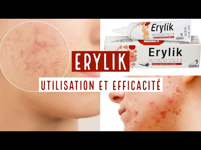 ERYLIK GEL POUR APPLICATION CUTANNÉE - YouTube