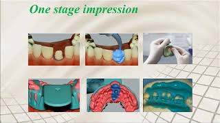 IMPRESSION MAKING TECHNIQUES