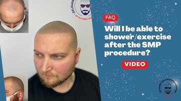 Will I Be Able to Shower or Exercise After the SMP Procedure?