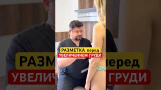 Детальная разметка груди перед увеличением. Как увеличить грудь? Пластический хирург Киев