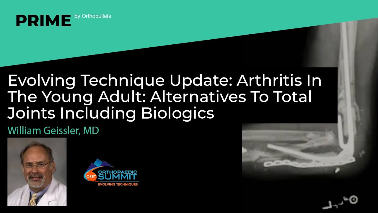 Arthritis In Young Adult Alternatives To Total Joints Including