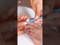 How I care for fungal nails as a nail tech 💅#nails #nailfungustreatment #nailfungus #nailtech