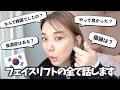 【フェイスリフト】ダウンタイムについて。質問返し、これまでの経過のお話。