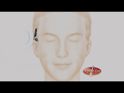 Cochlear Implants: Hearing