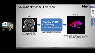 Using VivoQuant for Translation of Image Analysis Methods from Discovery to Core Lab Jacob Hesterman