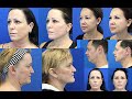 Dr. Dennis Dass Shows Facelift Results Of 4 Patients