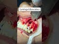 Dental surgery Apicoectomy | Best Dental Care Ghaziabad