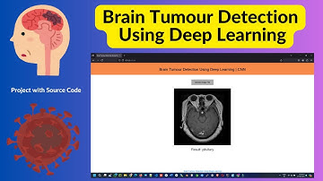 Brain Tumour Detection Project Using Deep Learning From MRI Image | Source Code | Web App