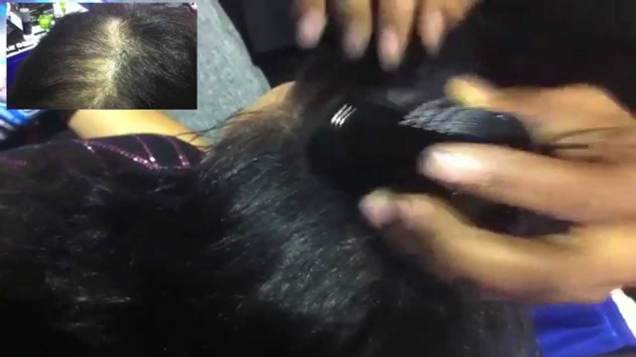Our Thin Hair Miracle The Women And Men Love In Meantime You Our Thin Hair Miracle The Women And Men Love In Meantime