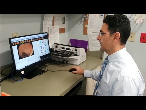 Could gut bacteria affect diabetes treatments?