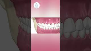 Türkiyede Kemik Grefti