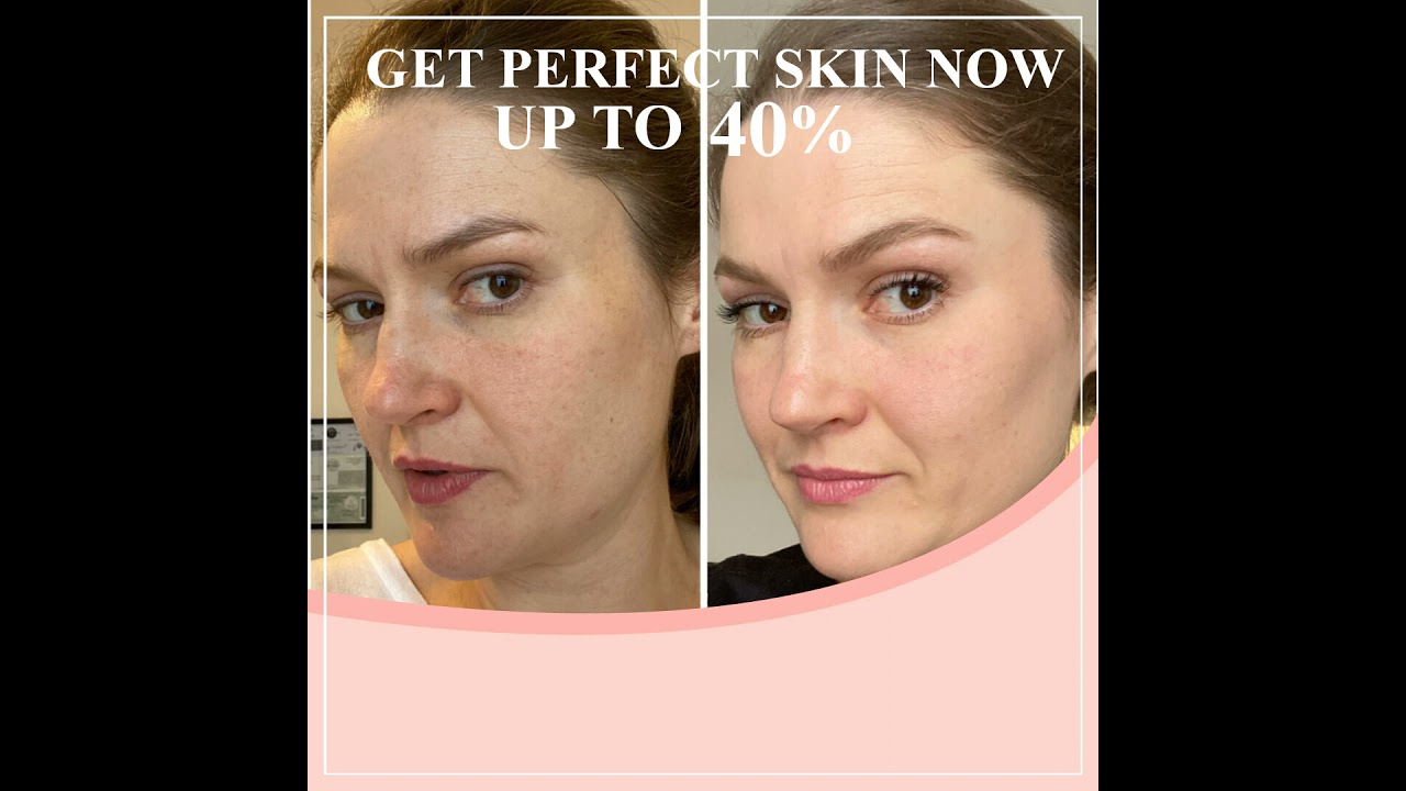 WHAT IS HYDROSSENTIAL SERUM?