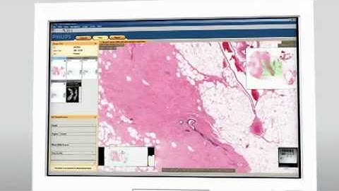 Pathology Solutions - Philips Digital Pathology