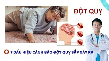 7 dấu hiệu cảnh báo đột quỵ sắp xảy ra | CÓ THỂ BẠN CHƯA BIẾT #songkhoe