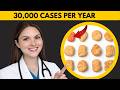 Common Meal Causes TOTAL PARALYSIS: Medical Mystery Solved