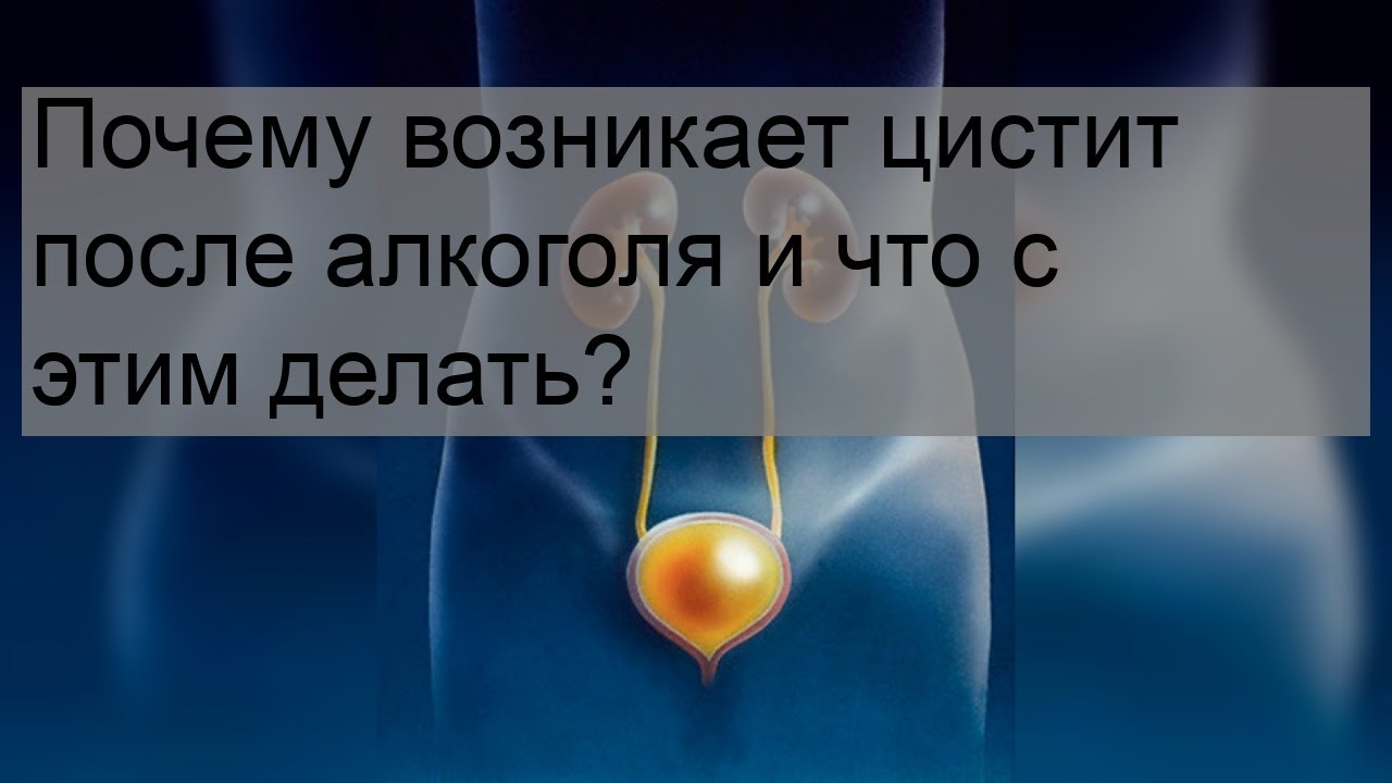 Почему возникает цистит после алкоголя и что с этим делать?