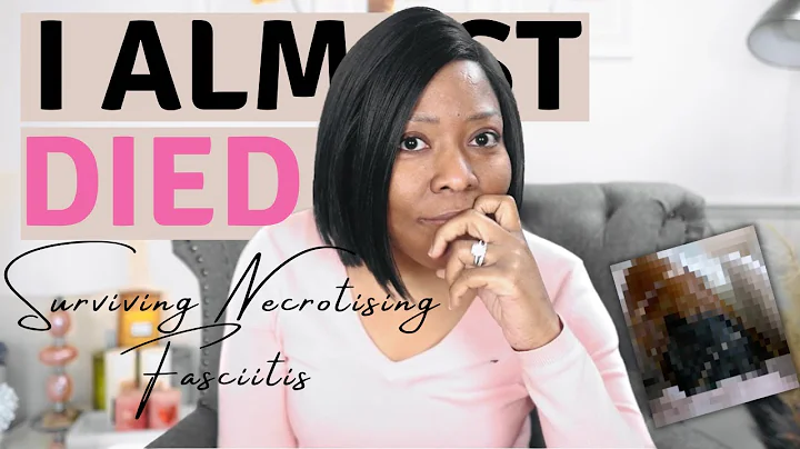 Story time: I Almost Died From a Rare Illness