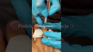 Zabieg Podologiczny, Pedicure, Manicure Hybrydowy Pro Laser Clinic