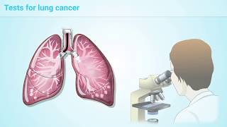 What is Lung Cancer?