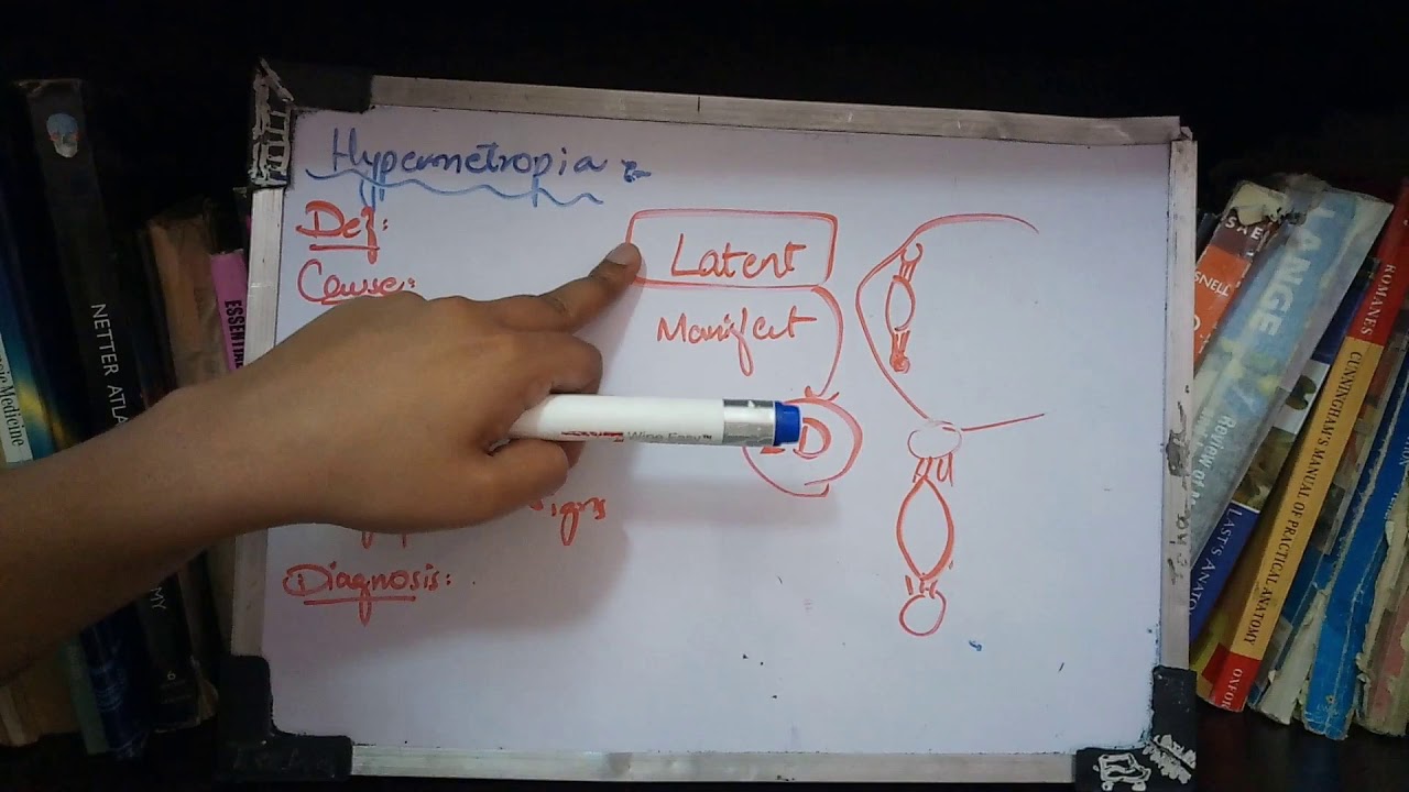 hyperopia 8 egyéves gyermekeknél, mit kell tenni