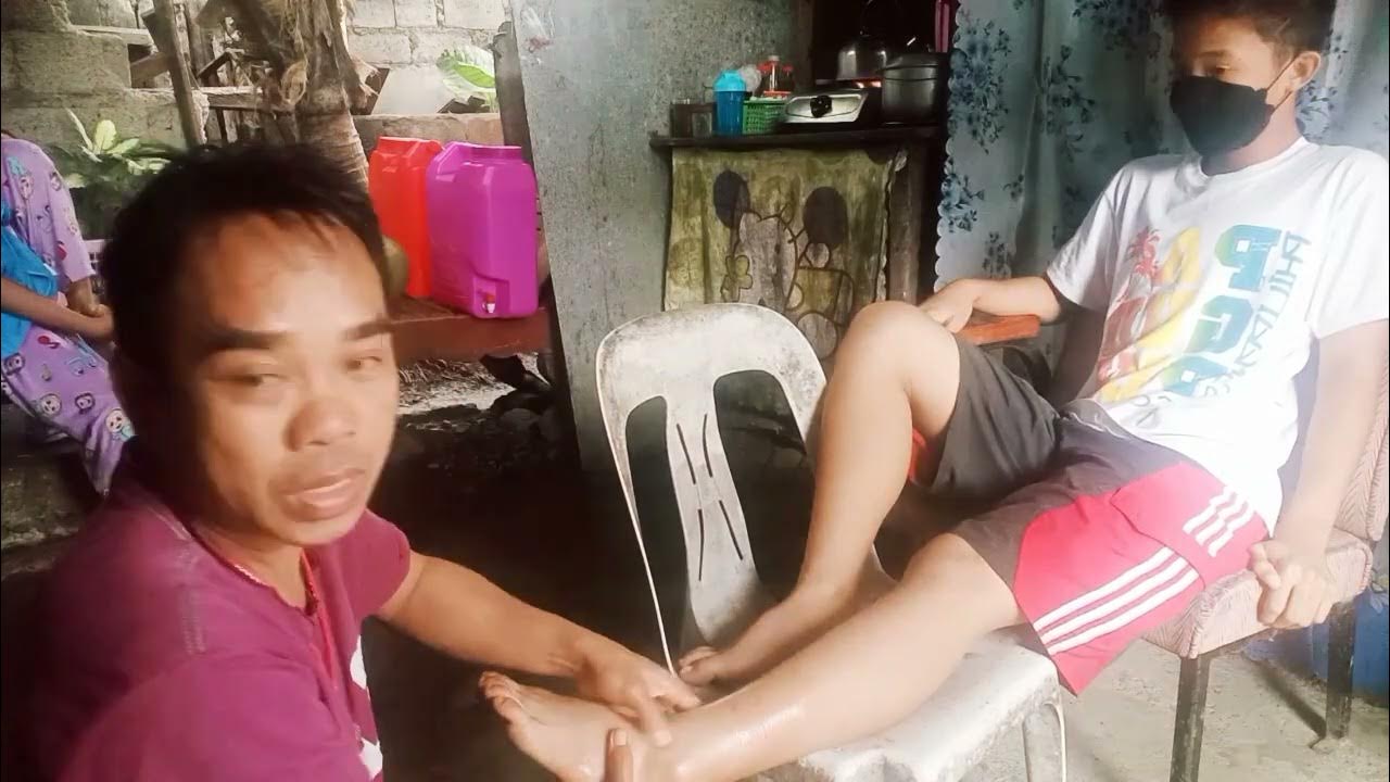 natapilok Ang paa namaga Ng husto by kumander sator arbolaryo - YouTube