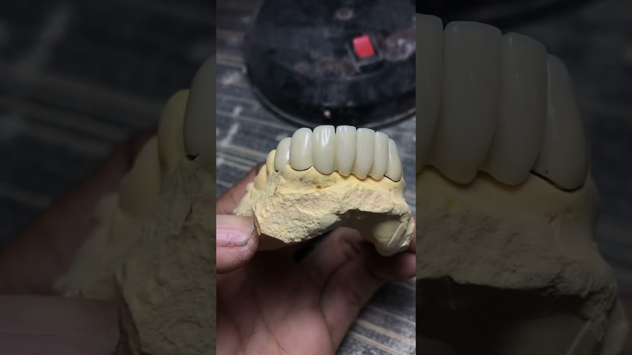 7points Loire vita pro ceramic 