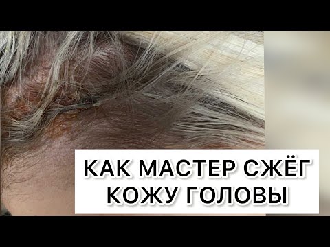 Как мастер сжег кожу головы клиентке..