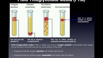 Basics of Fluid Thioglycollate Media (FTM) | With Examples