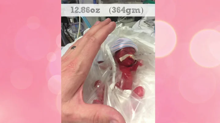 Baby naomi born 15 weeks premature
