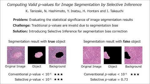 Computing Valid P-Values for Image Segmentation by Selective Inference