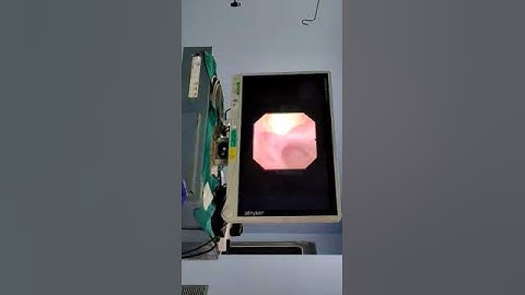 RIRS by Dr Naidu Apollo Hospital with HugeMed URS HU30S