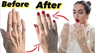 Best Remedy for Dry and Wrinkled Hands | wrinkled free smooth fair hands