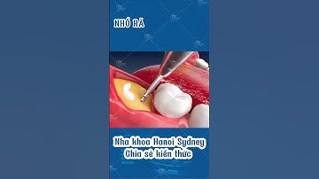 Bạn đã nhổ răng khôn chưa? #nhakhoahanoisydney  #nhổrăngkhôn  #răngkhôn #shorts