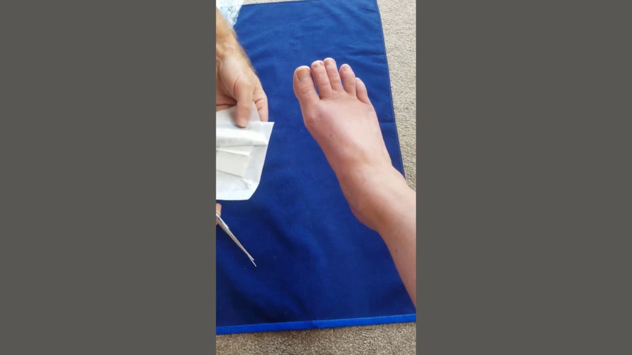 Instruction on how to use our Toe Dressing Pack YouTube