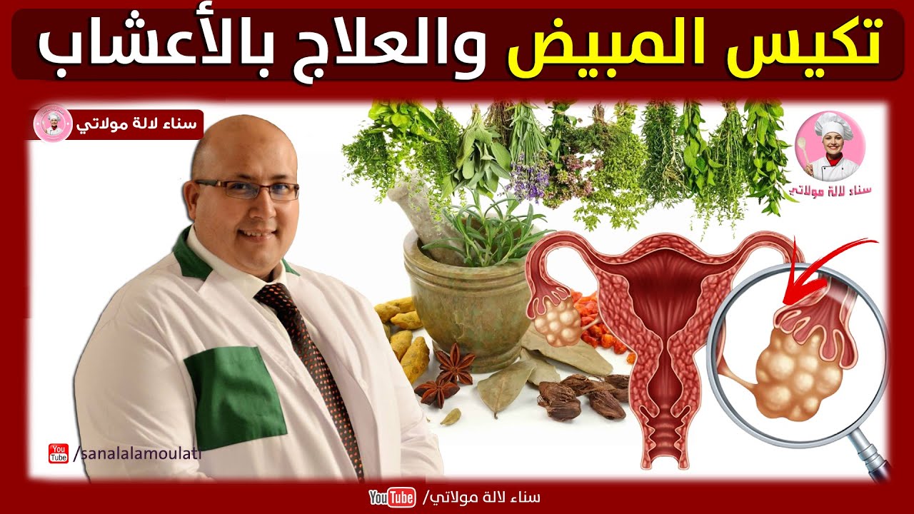 هل يمكن علاج تكيس المبيض بالاعشاب والعسل !! الجواب مع الدكتور عماد ميزاب Imad Mizab