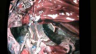 Gears Of War 2 - Inside The Riftworm Riftworm Heart