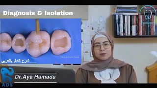 Posterior Composite - Diagnosis And Isolation