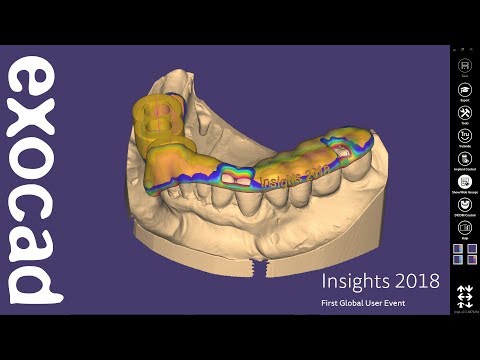 INSIGHTS 2018: exoplan Case Demonstration - Planning of implants and design of a surgical guide