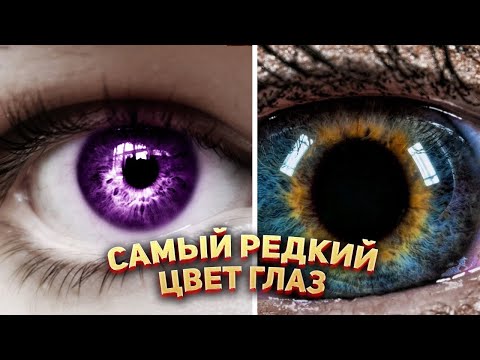 Самый Редкий Цвет Глаз