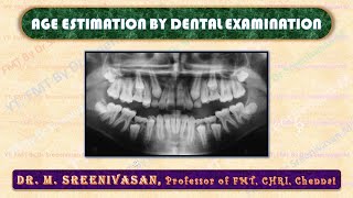 AGE ESTIMATION BY DENTAL EXAMINATION Age Determination By Teeth With Solved Exercises