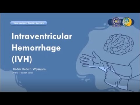 Neurosurgery Sunday Lecture - Intraventricular Hemorrhage
