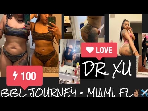 bbl-journey-||-mia-aesthetics-||-miami,-fl-||-dr.-xu