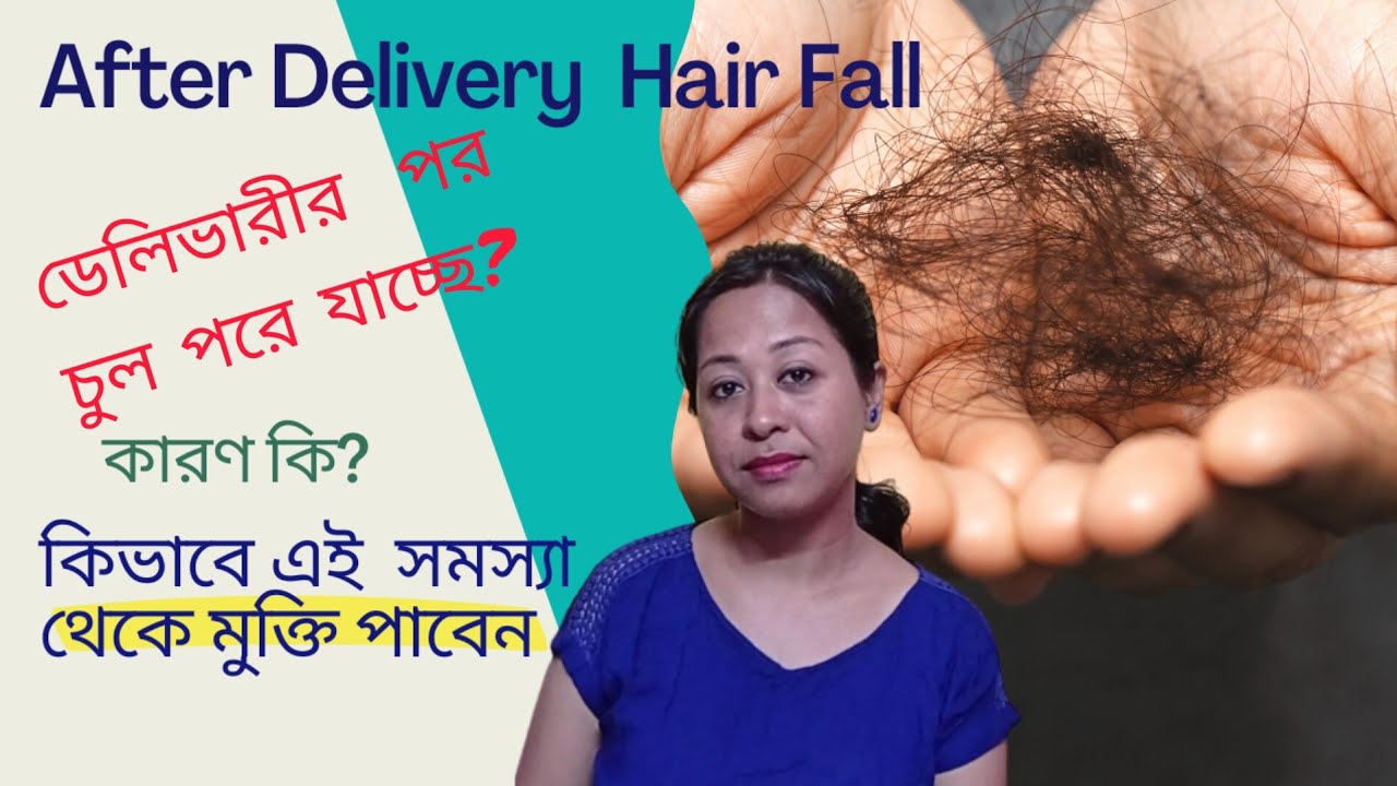 After Delivery Hair Fall In Bengali Postpartum Hair Fall after-delivery-hair-fall-in-bengali-postpartum-hair-fall