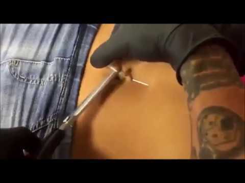 Video: Geïnfecteerde Navelpiercing: Reinigingstips En Meer